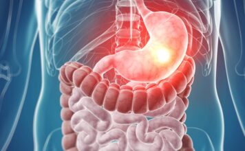 tumores del estroma gastrointestinal