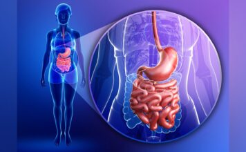 QINLOCK como un tratamiento potencial para pacientes con tumores del estroma gastrointestinal
