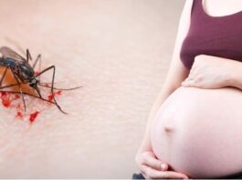 Zika podría haber afectado el desarrollo de bebés nacidos sin microcefalia