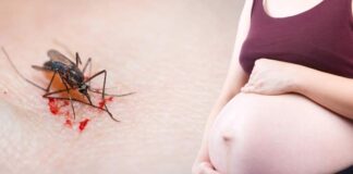Zika podría haber afectado el desarrollo de bebés nacidos sin microcefalia