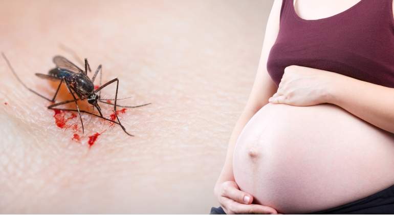 Zika podría haber afectado el desarrollo de bebés nacidos sin microcefalia