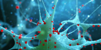 antihistamínicos, enfermedad de Huntington