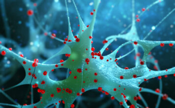 antihistamínicos, enfermedad de Huntington