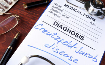 enfermedades priónicas, tratamiento