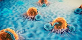 linfoma de células del manto, tratamiento