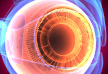 nanopartículas de polímero, distrofia retiniana