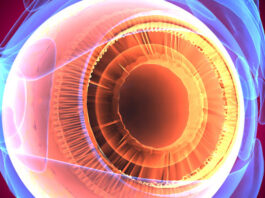 nanopartículas de polímero, distrofia retiniana