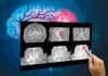 tumor cerebral, investigaciónes_biomédicas
