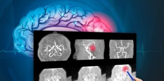 tumor cerebral, investigaciónes_biomédicas