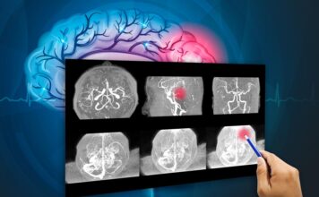 tumor cerebral, investigaciónes_biomédicas