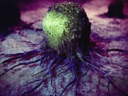 Exicure, cavrotolimod, tratamiento, tumores solidos, pembrolizumab