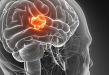 Glioblastoma, oncogén