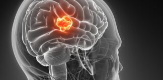 Glioblastoma, oncogén