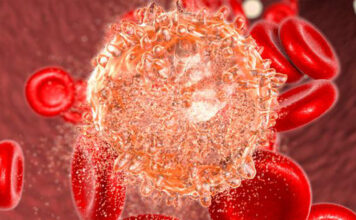 Novartis, medicamento asciminib, leucemia mieloide crónica