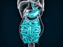 QINLOCK como un tratamiento para los tumores del estromal