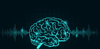 Soticlestat, convulsiones, niños Dravet