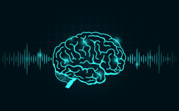 Soticlestat, convulsiones, niños Dravet