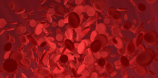 actualizaciones sobre neoplasias mieloproliferativas