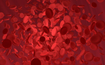 actualizaciones sobre neoplasias mieloproliferativas