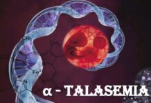 alfa talasemia, recién nacidos