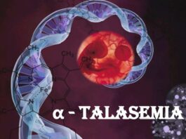 alfa talasemia, recién nacidos
