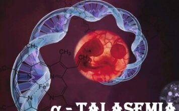 alfa talasemia, recién nacidos