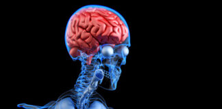 mecanismo inmunitario, muerte celular, enfermedad de Huntington