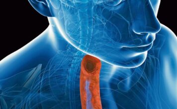 Dupilumab tratamiento, esofagitis eosinofílica