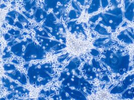 inmunocitocinas ser una forma de combatir el glioblastoma