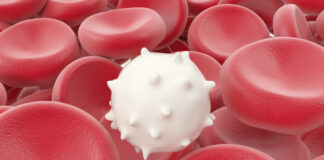 medicamento Nucala, síndrome hipereosinofílico