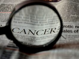 terapia de investigación para pacientes con mielofibrosis con trombocitopenia grave