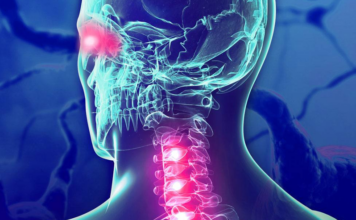 terapias, trastorno espectro de neuromielitis óptica