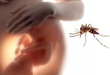 alteraciones moleculares, virus Zika, cerebro bebé gestación
