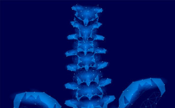 características clínicas osteomielitis crónica no bacteriana