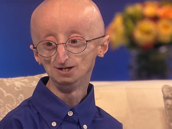 progeria, magnesio