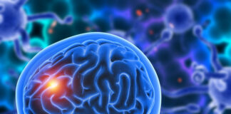 test en sangre, tumores cerebrales