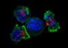 Mejora células T, combaten el cáncer
