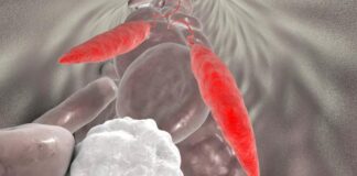 diana potencial crear vacunas leishmaniasis