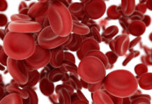 hemofilia B, terapia génica, etranacogen dezaparvovec