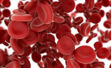hemofilia B, terapia génica, etranacogen dezaparvovec