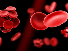 prueban terapia génica, anemia falciforme