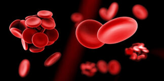 prueban terapia génica, anemia falciforme