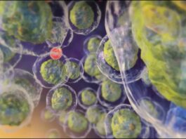 vacuna remisión, leucemia mieloide aguda a largo plazo