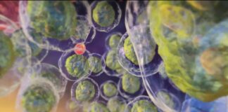 vacuna remisión, leucemia mieloide aguda a largo plazo