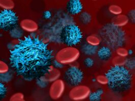 9 signos de cáncer de sangre que los médicos suelen pasar por alto