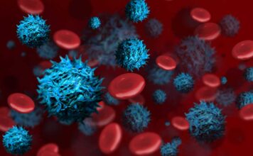 9 signos de cáncer de sangre que los médicos suelen pasar por alto