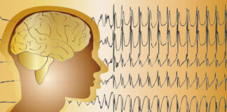 Análisis descriptivo electroencefalograma síndrome de Angelman