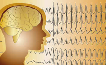 Análisis descriptivo electroencefalograma síndrome de Angelman