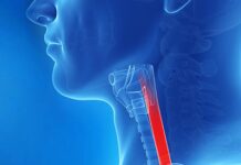 FDA revisión primera terapia esofagitis eosinofílica