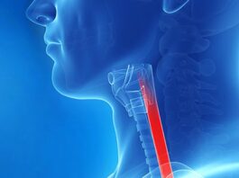 FDA revisión primera terapia esofagitis eosinofílica